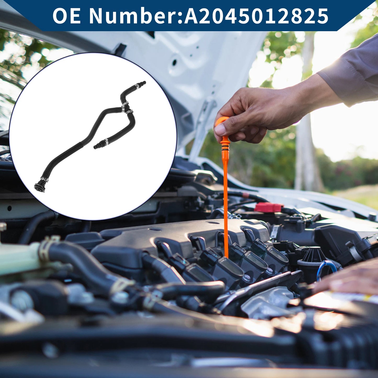 Radiator Hose for Mercedes-Benz C-Class C180 C204 (2013-2024)