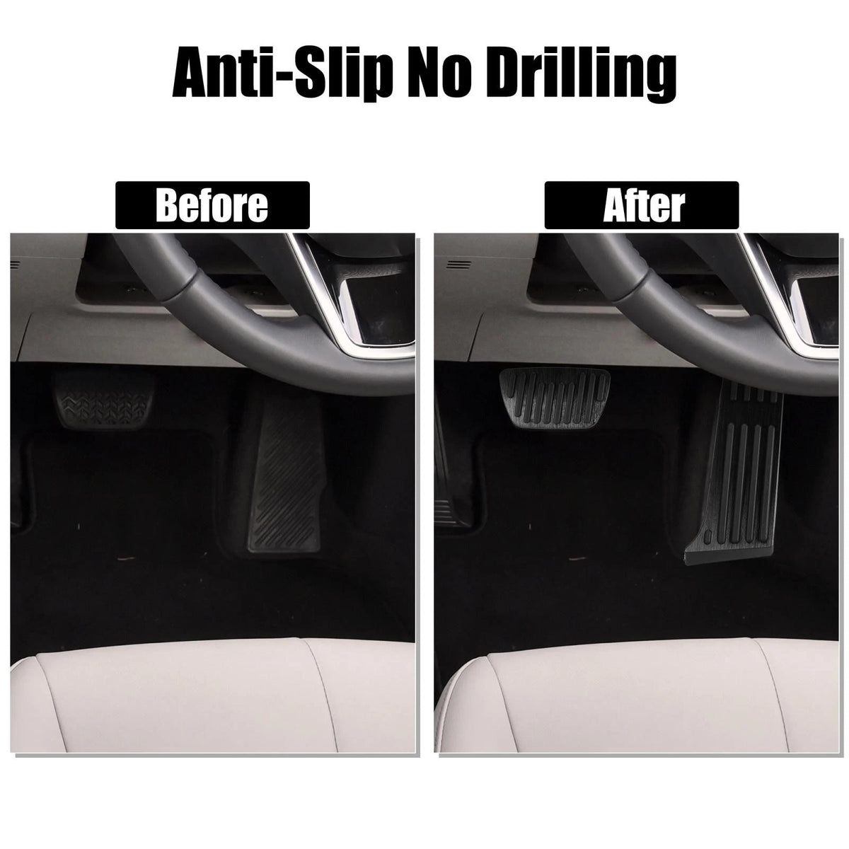 Anti-Slip Brake & Gas Pedal Covers Kit for Toyota (Fits Various Models)