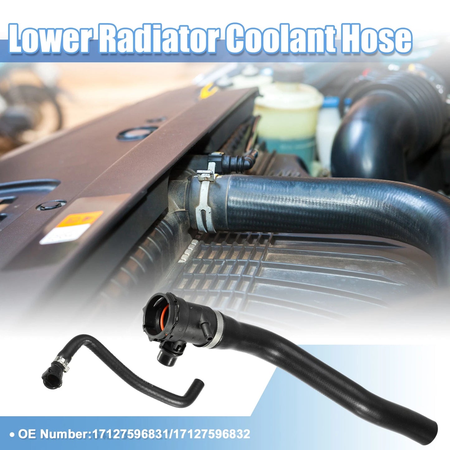 Radiator Coolant Hose Set for BMW 320i Base 2.0L (2012-2013)