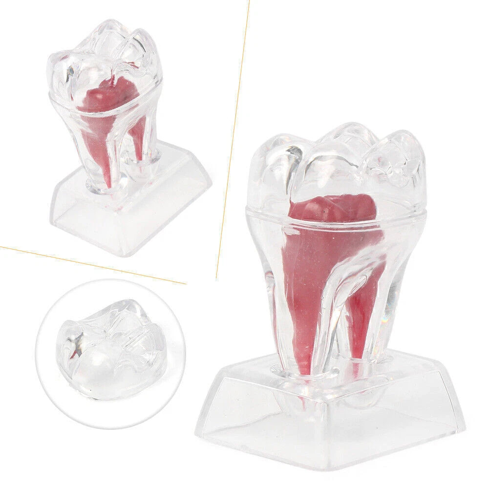 Dental Crystal Base Hard Plastic Tooth Molar Teaching Tool Kit for Dental Use