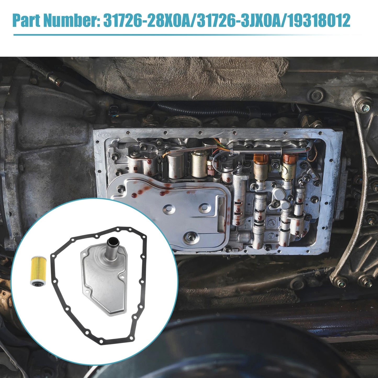 Transmission Oil Filters & Pan Gasket Set for Nissan Sentra (2013-2018)